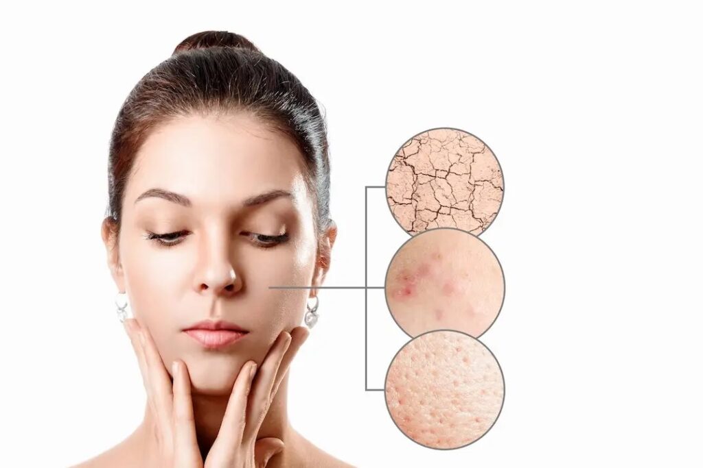 5 Common Skin Concerns & Their Available Treatments